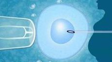 二代试管期间NT增厚的原因和什么有关